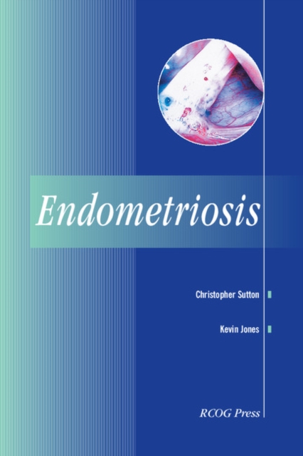 Endometriosis, EPUB eBook