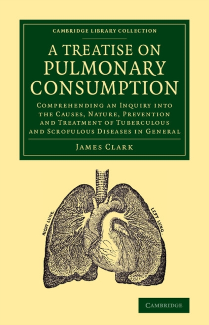 A Treatise on Pulmonary Consumption : Comprehending an Inquiry into the Causes, Nature, Prevention and Treatment of Tuberculous and Scrofulous Diseases in General, Paperback / softback Book