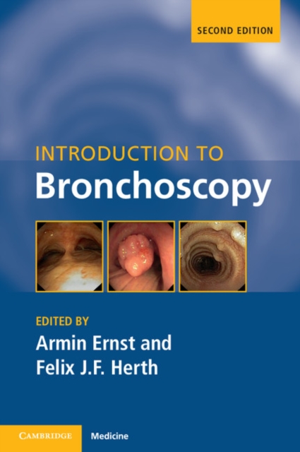 Introduction to Bronchoscopy, PDF eBook