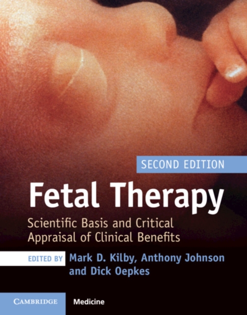 Fetal Therapy : Scientific Basis and Critical Appraisal of Clinical Benefits, Hardback Book