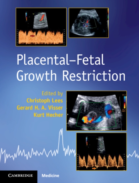 Placental-Fetal Growth Restriction, PDF eBook