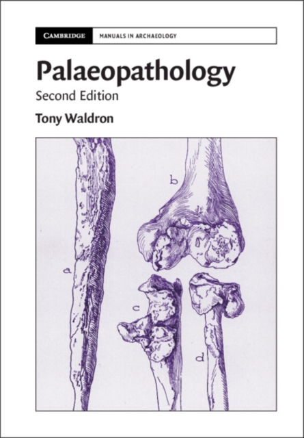 Palaeopathology, PDF eBook