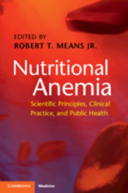Nutritional Anemia : Scientific Principles, Clinical Practice, and Public Health, Paperback / softback Book