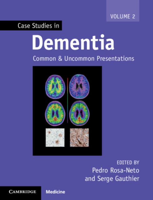 Case Studies in Dementia : Common and Uncommon Presentations, PDF eBook
