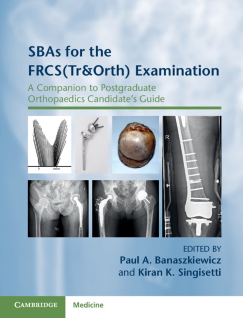 SBAs for the FRCS(Tr&Orth) Examination : A Companion to Postgraduate Orthopaedics Candidate's Guide, Paperback / softback Book