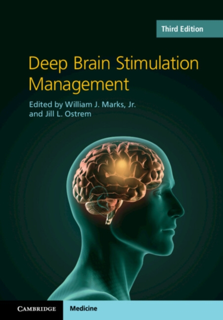 Deep Brain Stimulation Management, PDF eBook