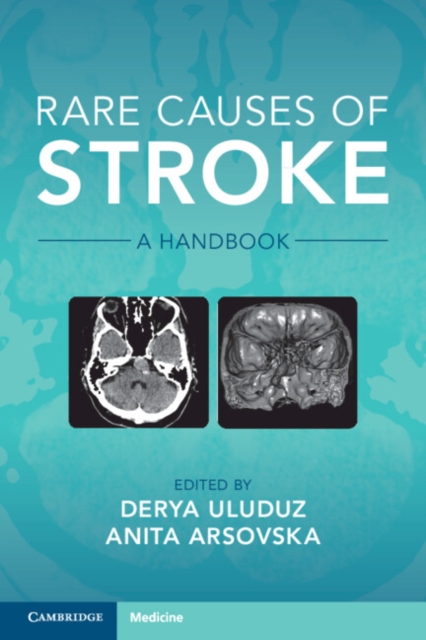 Rare Causes of Stroke : A Handbook, EPUB eBook