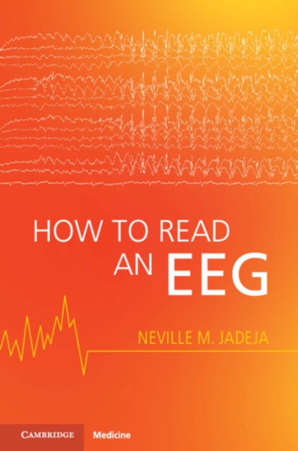 How to Read an EEG, PDF eBook