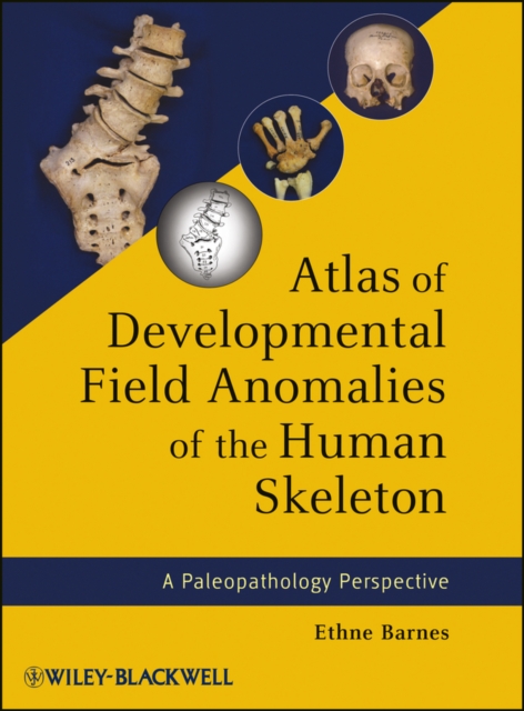Atlas of Developmental Field Anomalies of the Human Skeleton : A Paleopathology Perspective, Hardback Book