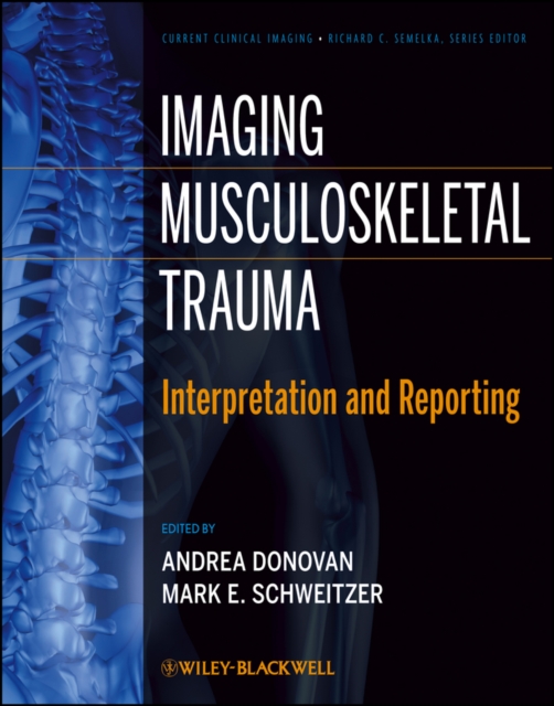 Imaging Musculoskeletal Trauma : Interpretation and Reporting, Hardback Book