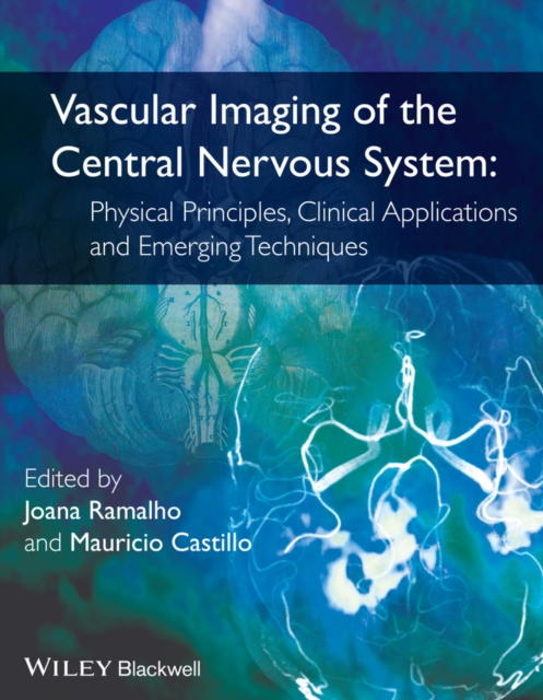 Vascular Imaging of the Central Nervous System : Physical Principles, Clinical Applications, and Emerging Techniques, Hardback Book