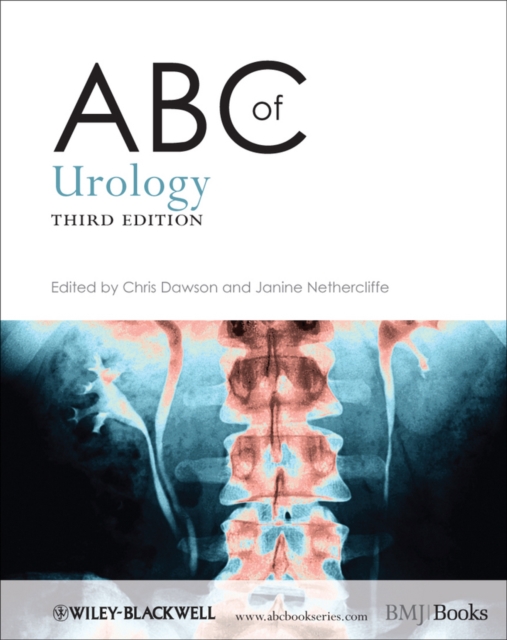 ABC of Urology, EPUB eBook