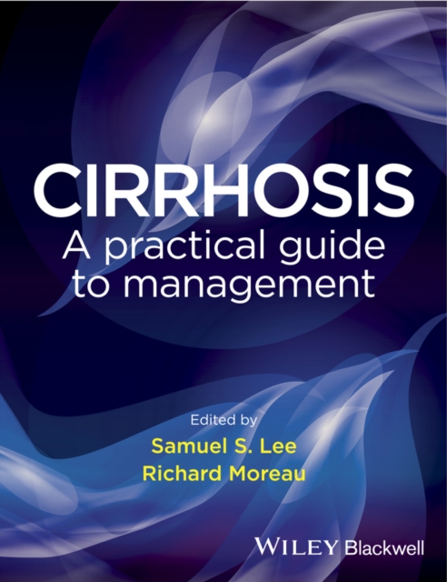 Cirrhosis : A Practical Guide to Management, Hardback Book