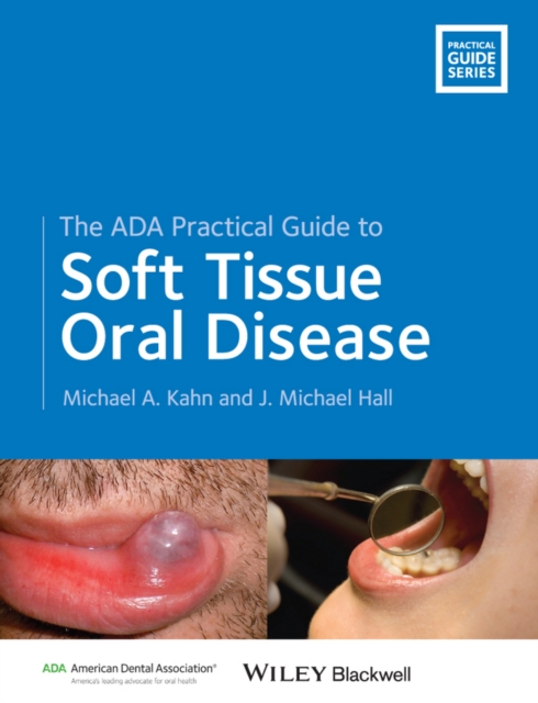 The ADA Practical Guide to Soft Tissue Oral Disease, Paperback / softback Book