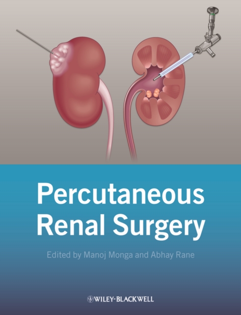 Percutaneous Renal Surgery, Hardback Book