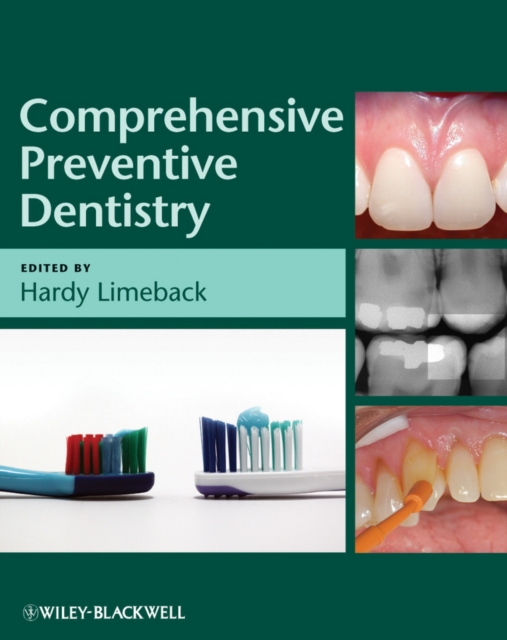Comprehensive Preventive Dentistry, PDF eBook