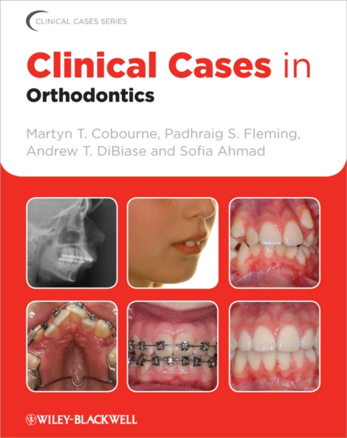 Clinical Cases in Orthodontics, EPUB eBook