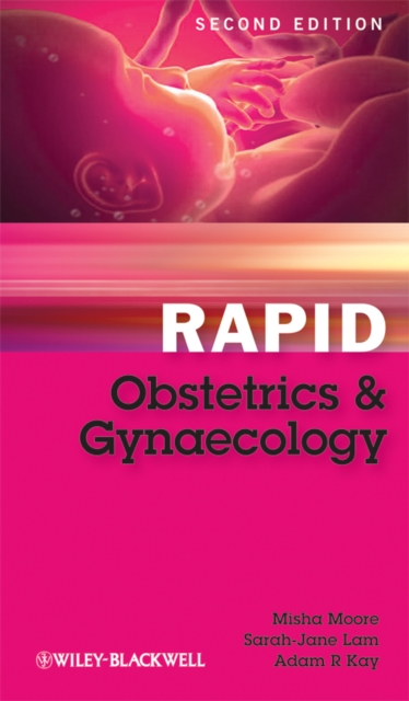 Rapid Obstetrics and Gynaecology, PDF eBook