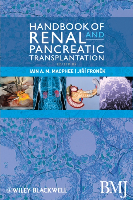 Handbook of Renal and Pancreatic Transplantation, EPUB eBook