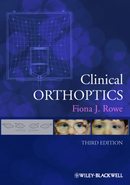 Clinical Orthoptics, PDF eBook