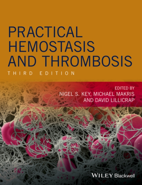 Practical Hemostasis and Thrombosis, Hardback Book