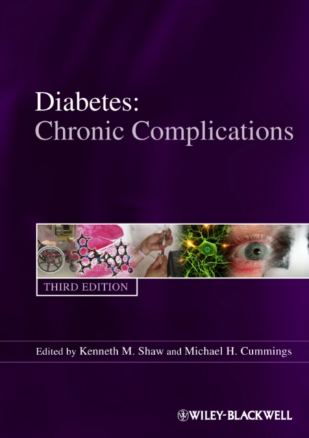 Diabetes : Chronic Complications, EPUB eBook