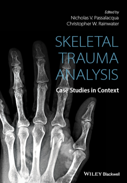 Skeletal Trauma Analysis : Case Studies in Context, Hardback Book