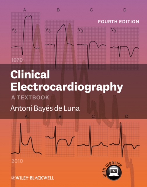 Clinical Electrocardiography, PDF eBook