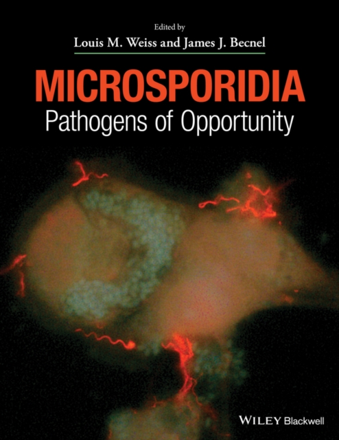 Microsporidia : Pathogens of Opportunity, EPUB eBook