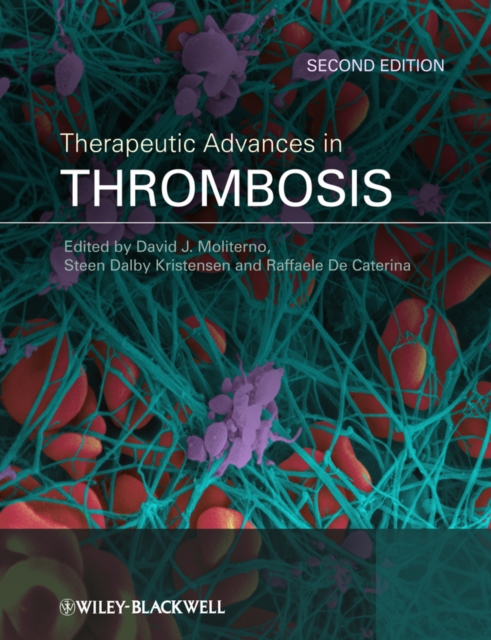 Therapeutic Advances in Thrombosis, EPUB eBook