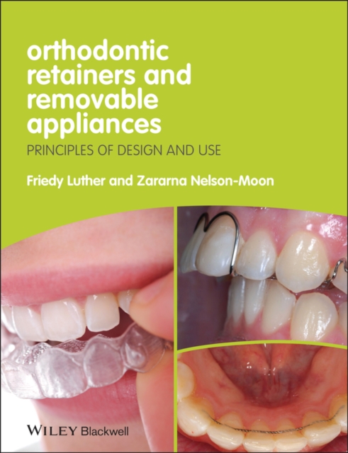 Orthodontic Retainers and Removable Appliances : Principles of Design and Use, PDF eBook