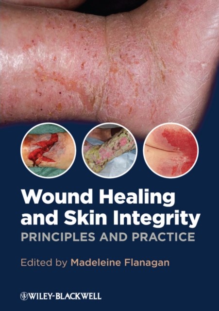 Wound Healing and Skin Integrity : Principles and Practice, PDF eBook