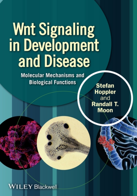 Wnt Signaling in Development and Disease : Molecular Mechanisms and Biological Functions, EPUB eBook