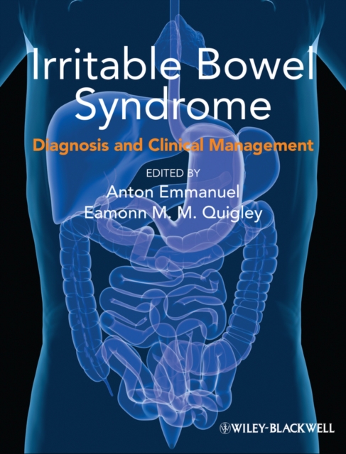 Irritable Bowel Syndrome : Diagnosis and Clinical Management, EPUB eBook