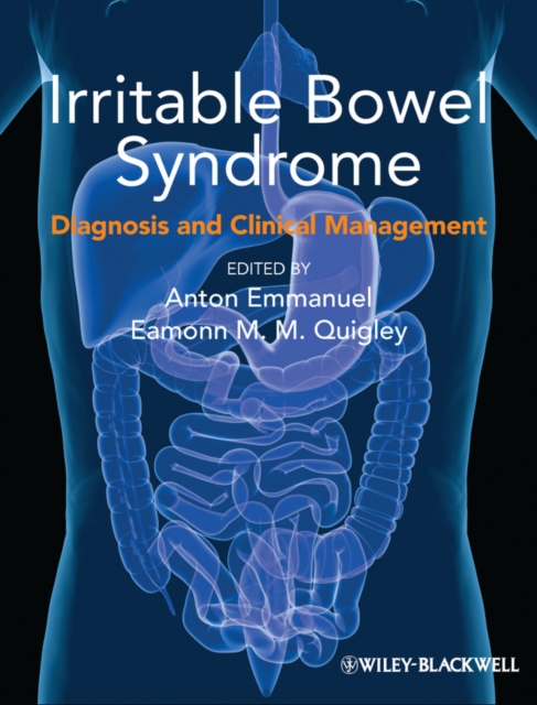 Irritable Bowel Syndrome : Diagnosis and Clinical Management, PDF eBook