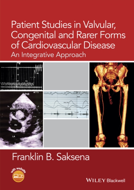 Patient Studies in Valvular, Congenital, and Rarer Forms of Cardiovascular Disease : An Integrative Approach, EPUB eBook