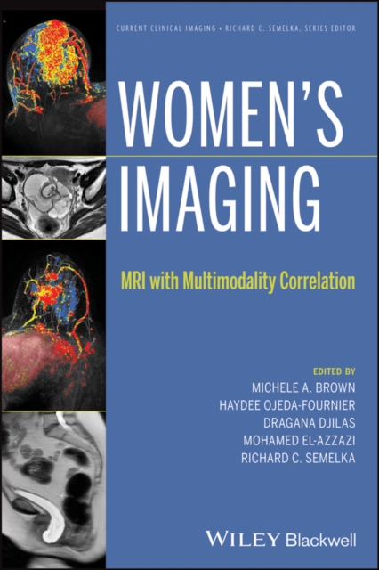 Women's Imaging : MRI with Multimodality Correlation, Hardback Book