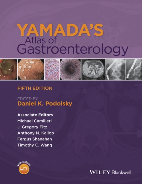 Yamada's Atlas of Gastroenterology, Hardback Book