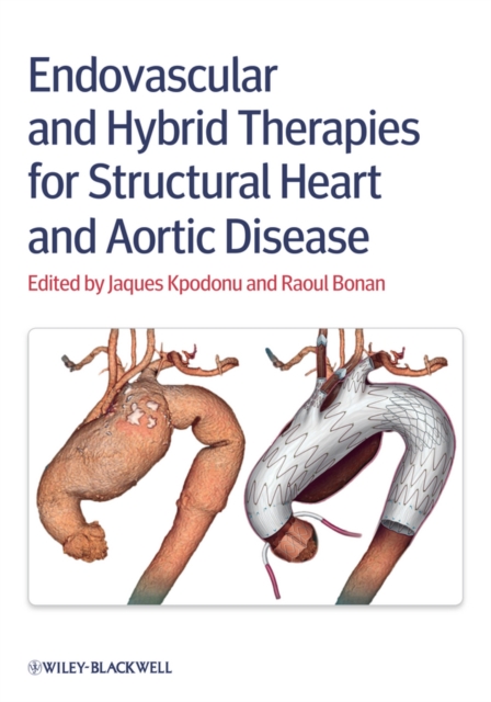 Endovascular and Hybrid Therapies for Structural Heart and Aortic Disease, PDF eBook
