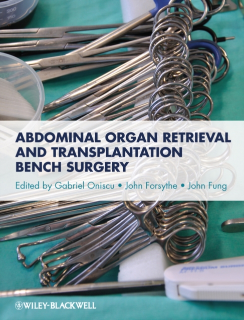 Abdominal Organ Retrieval and Transplantation Bench Surgery, PDF eBook