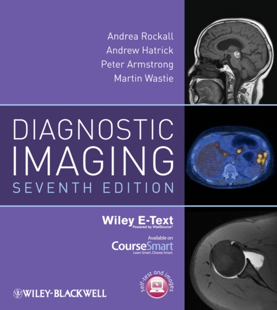 Diagnostic Imaging, PDF eBook