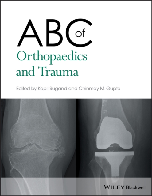 ABC of Orthopaedics and Trauma, EPUB eBook