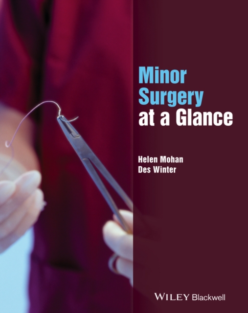 Minor Surgery at a Glance, Paperback / softback Book
