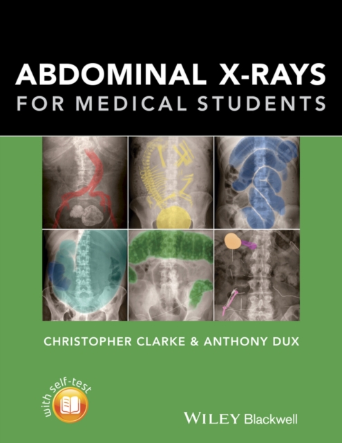 Abdominal X-rays for Medical Students, Paperback / softback Book