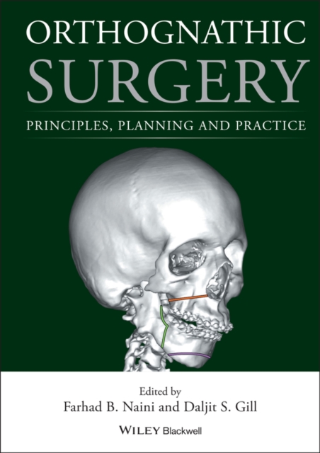 Orthognathic Surgery : Principles, Planning and Practice, EPUB eBook