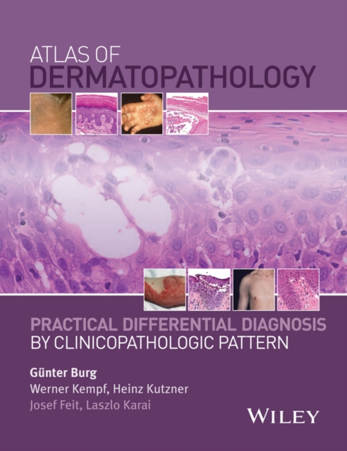 Atlas of Dermatopathology : Practical Differential Diagnosis by Clinicopathologic Pattern, Hardback Book