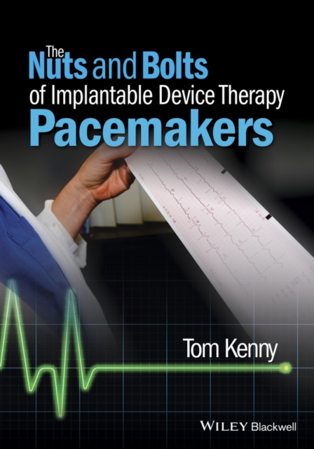 The Nuts and Bolts of Implantable Device Therapy : Pacemakers, PDF eBook