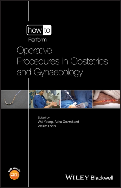 How to Perform Operative Procedures in Obstetrics and Gynaecology, Multiple-component retail product, part(s) enclose Book