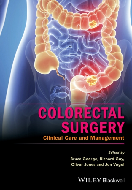 Colorectal Surgery : Clinical Care and Management, PDF eBook