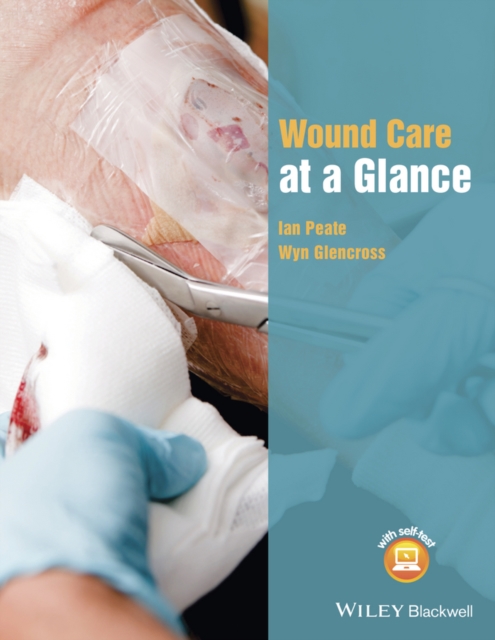 Wound Care at a Glance, Paperback / softback Book